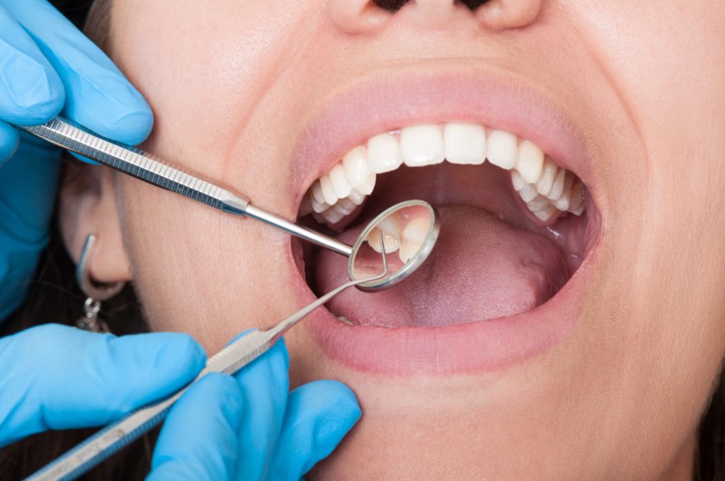 Dentist Chirnside Park - Gives The Best Forms of Dental Care Services